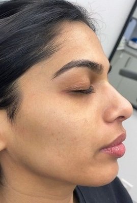 After Smooth Texture